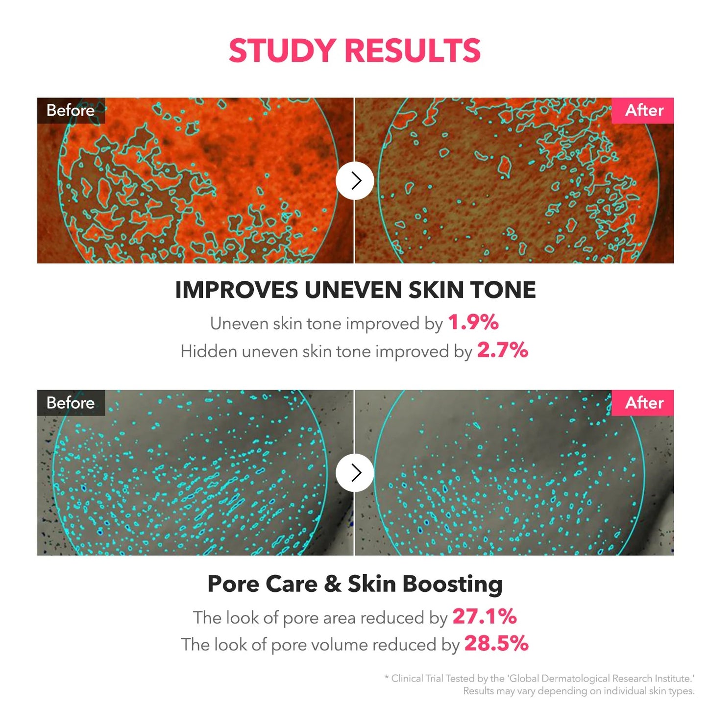 Dark Spot Fading Duo: TXA Niacinamide Milky Toner + 99 Spicule Serum